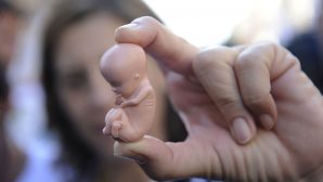 Gebelik Sonlandırma Haricindeki Kürtaj Nedenleri